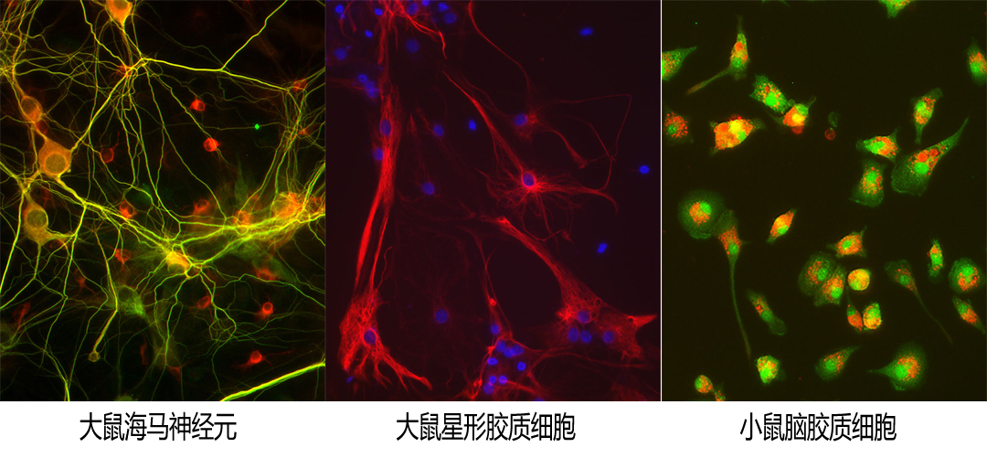 Lonza原代神經(jīng)元和膠質(zhì)細胞代理商